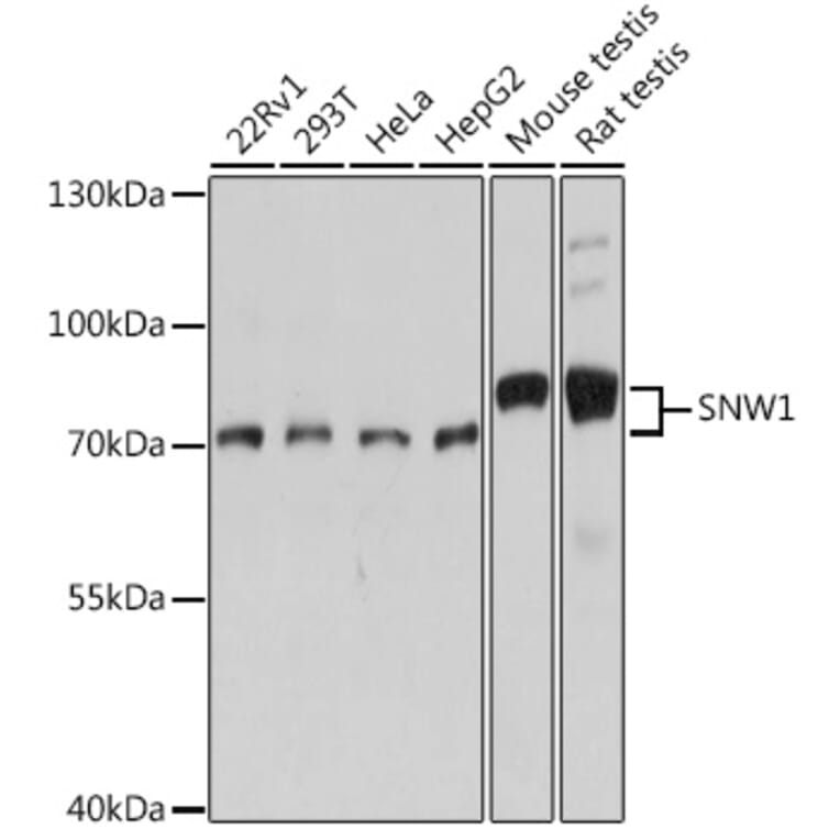 Western Blot - Anti-NCOA62/SNW1 Antibody (A92348) - Antibodies.com