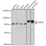 Western Blot - Anti-NCOA62/SNW1 Antibody (A92348) - Antibodies.com