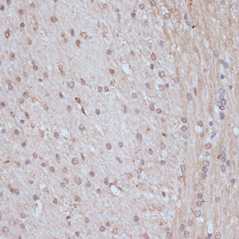 Immunohistochemistry - Anti-NCOA62/SNW1 Antibody (A92348) - Antibodies.com