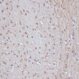Immunohistochemistry - Anti-NCOA62/SNW1 Antibody (A92348) - Antibodies.com