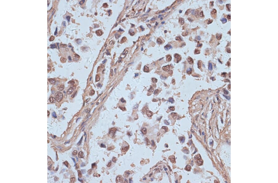 Immunohistochemistry - Anti-NCOA62/SNW1 Antibody (A92348) - Antibodies.com