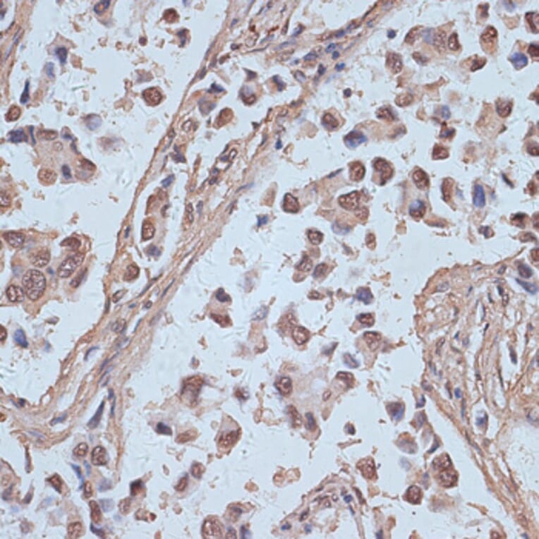 Immunohistochemistry - Anti-NCOA62/SNW1 Antibody (A92348) - Antibodies.com