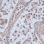 Immunohistochemistry - Anti-NCOA62/SNW1 Antibody (A92348) - Antibodies.com