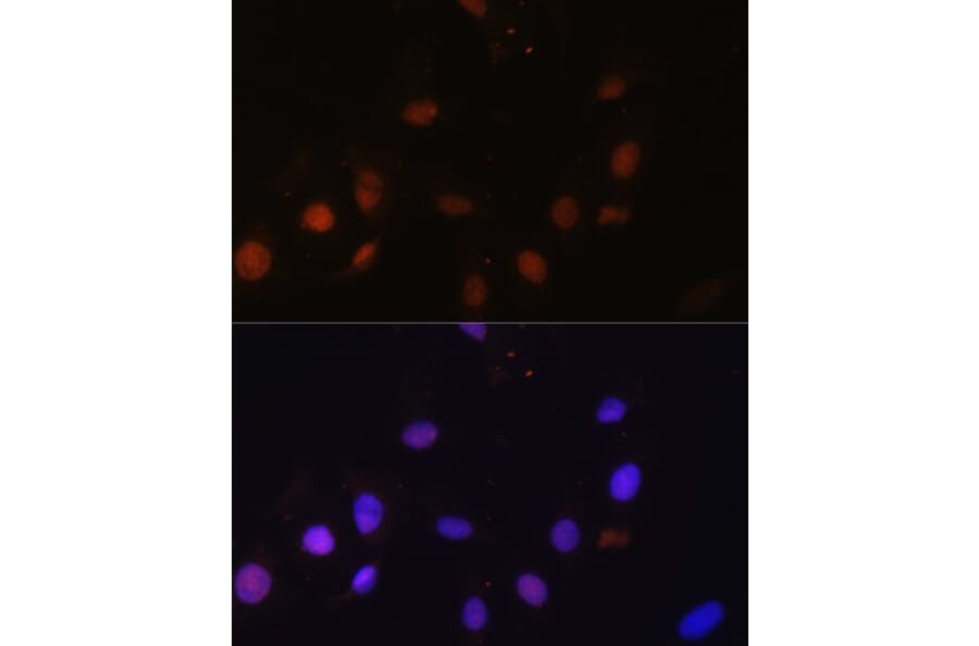 Immunofluorescence - Anti-NCOA62/SNW1 Antibody (A92348) - Antibodies.com