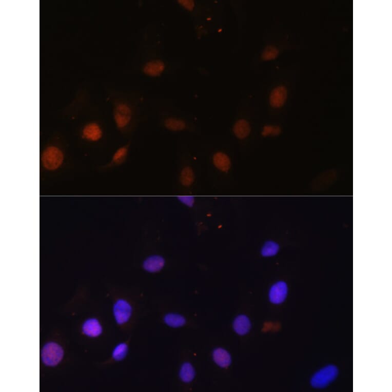 Immunofluorescence - Anti-NCOA62/SNW1 Antibody (A92348) - Antibodies.com