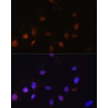 Immunofluorescence - Anti-NCOA62/SNW1 Antibody (A92348) - Antibodies.com
