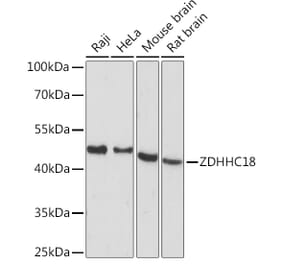 Western Blot - Anti-DHHC-18 Antibody (A92351) - Antibodies.com