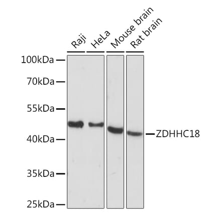 Western Blot - Anti-DHHC-18 Antibody (A92351) - Antibodies.com