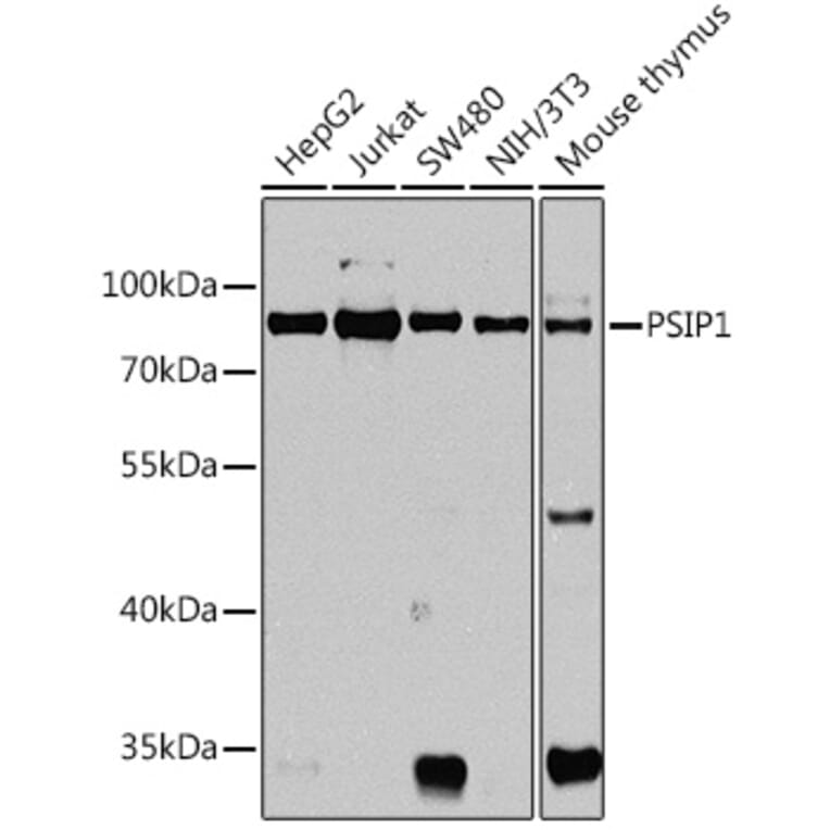 Western Blot - Anti-PSIP1/LEDGF Antibody (A92352) - Antibodies.com