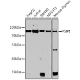 Western Blot - Anti-PSIP1/LEDGF Antibody (A92352) - Antibodies.com