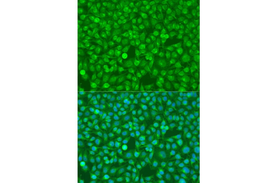 Immunofluorescence - Anti-CSF3 Antibody (A15660) - Antibodies.com
