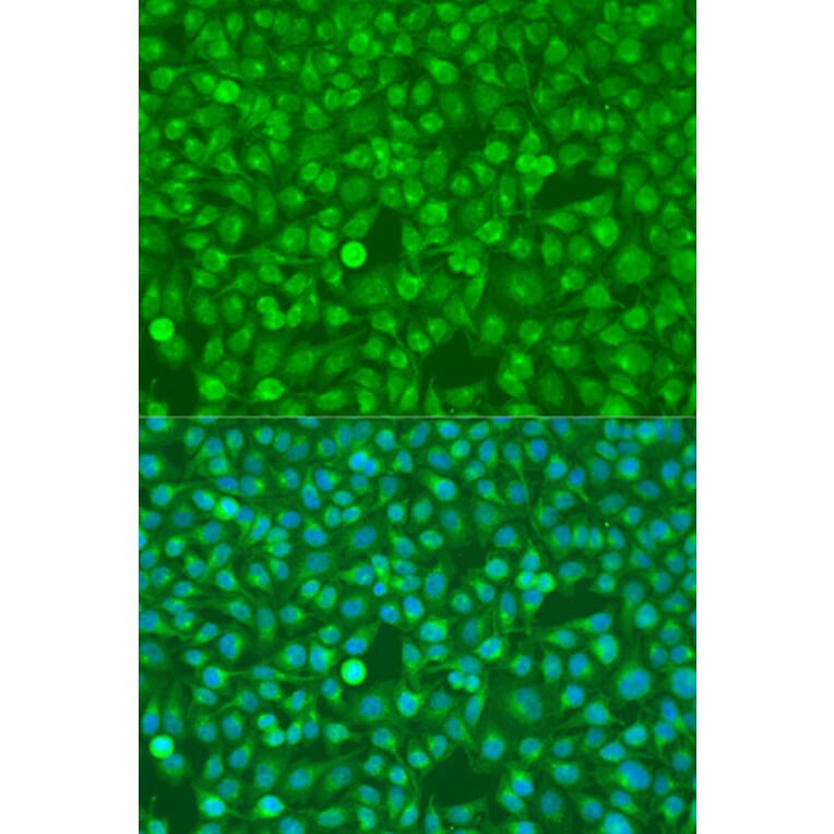 Immunofluorescence - Anti-CSF3 Antibody (A15660) - Antibodies.com