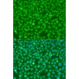 Immunofluorescence - Anti-CSF3 Antibody (A15660) - Antibodies.com