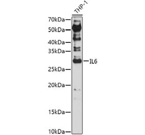 Western Blot - Anti-IL-6 Antibody (A92355) - Antibodies.com