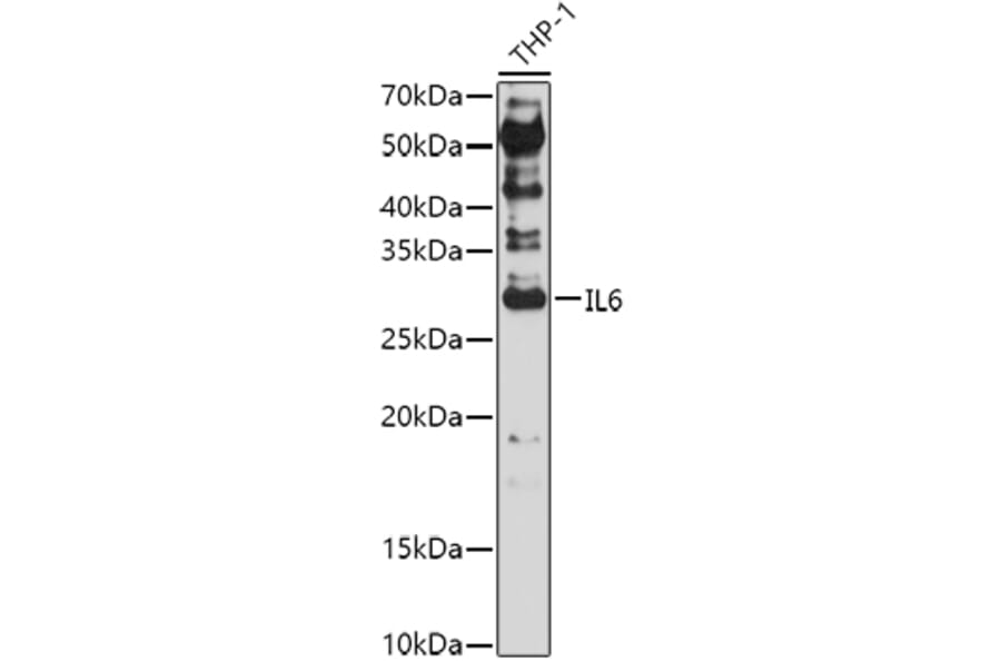 Western Blot - Anti-IL-6 Antibody (A92355) - Antibodies.com
