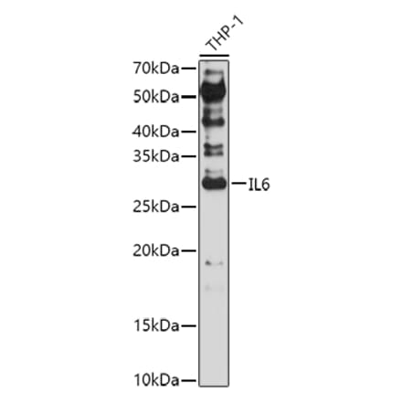 Western Blot - Anti-IL-6 Antibody (A92355) - Antibodies.com