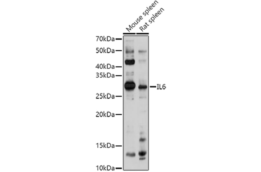 Western Blot - Anti-IL-6 Antibody (A92355) - Antibodies.com