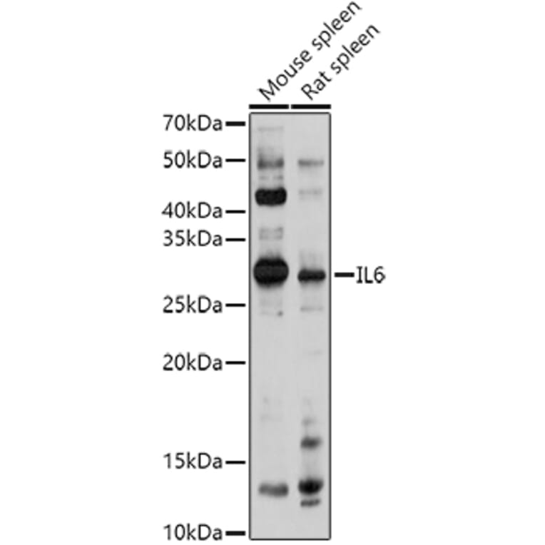 Western Blot - Anti-IL-6 Antibody (A92355) - Antibodies.com