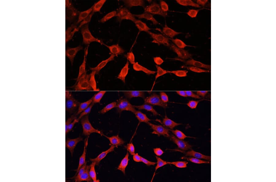Immunofluorescence - Anti-DNase I Antibody (A92356) - Antibodies.com