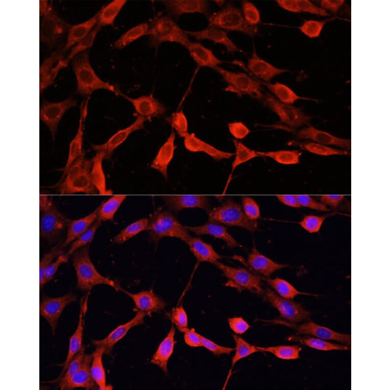 Immunofluorescence - Anti-DNase I Antibody (A92356) - Antibodies.com