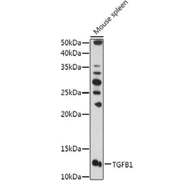 Western Blot - Anti-TGF beta 1 Antibody (A92358) - Antibodies.com