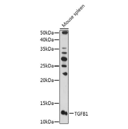 Western Blot - Anti-TGF beta 1 Antibody (A92358) - Antibodies.com