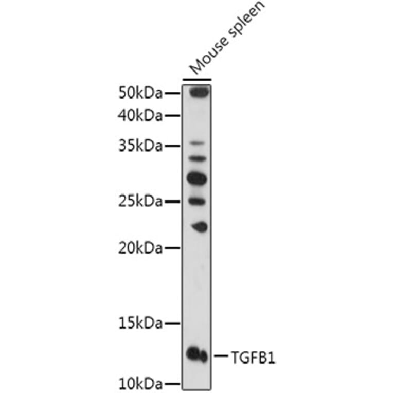 Western Blot - Anti-TGF beta 1 Antibody (A92358) - Antibodies.com