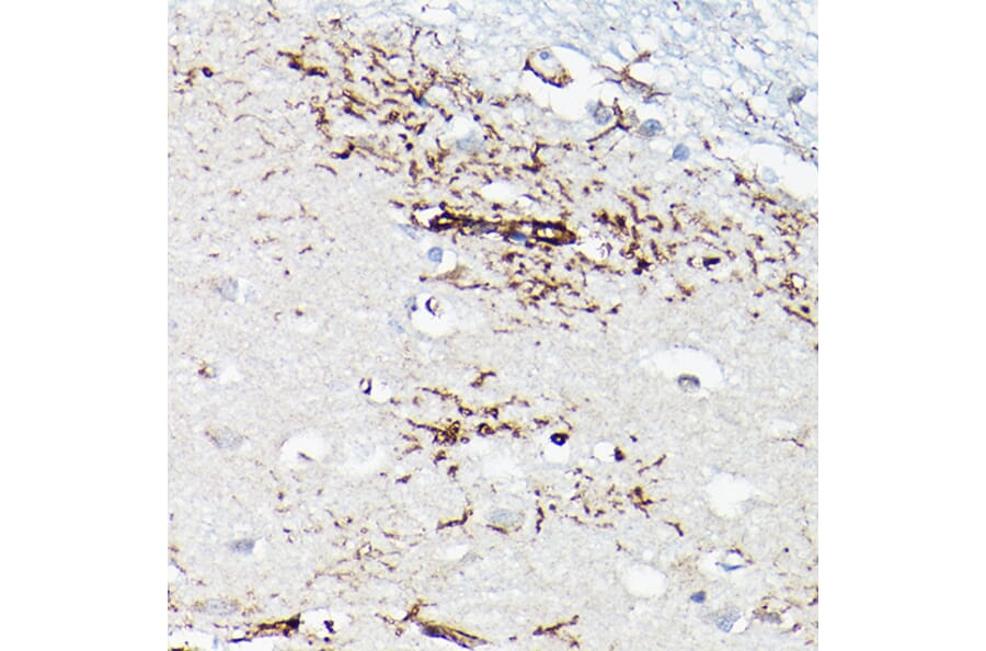 Immunohistochemistry - Anti-TGF beta 1 Antibody (A92358) - Antibodies.com
