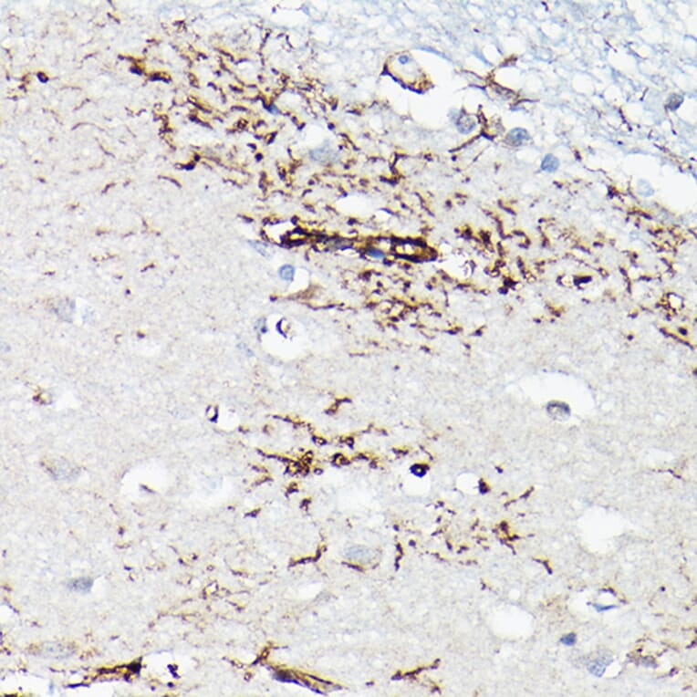 Immunohistochemistry - Anti-TGF beta 1 Antibody (A92358) - Antibodies.com