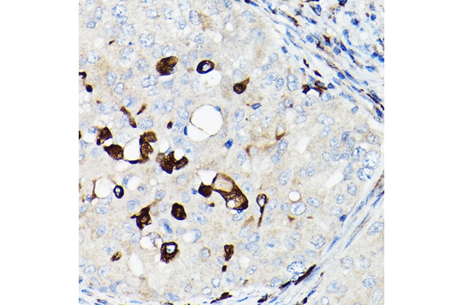 Immunohistochemistry - Anti-TGF beta 1 Antibody (A92358) - Antibodies.com
