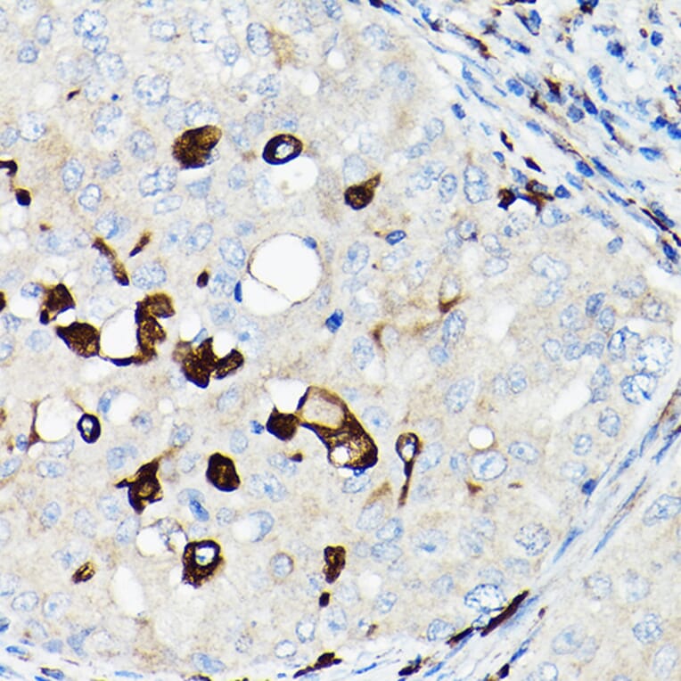 Immunohistochemistry - Anti-TGF beta 1 Antibody (A92358) - Antibodies.com