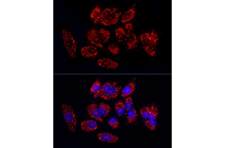 Immunofluorescence - Anti-TGF beta 1 Antibody (A92358) - Antibodies.com