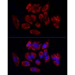 Immunofluorescence - Anti-TGF beta 1 Antibody (A92358) - Antibodies.com