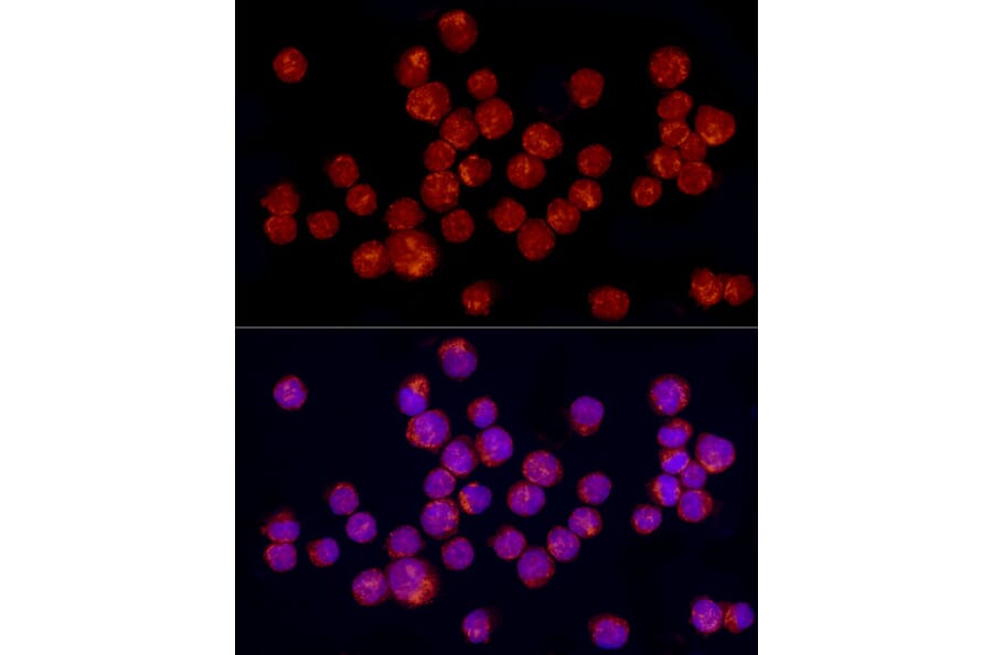 Immunofluorescence - Anti-TGF beta 1 Antibody (A92358) - Antibodies.com