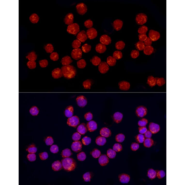 Immunofluorescence - Anti-TGF beta 1 Antibody (A92358) - Antibodies.com