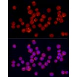 Immunofluorescence - Anti-TGF beta 1 Antibody (A92358) - Antibodies.com