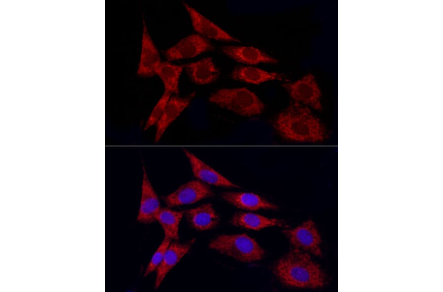 Immunofluorescence - Anti-TGF beta 1 Antibody (A92358) - Antibodies.com