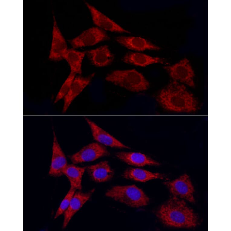 Immunofluorescence - Anti-TGF beta 1 Antibody (A92358) - Antibodies.com