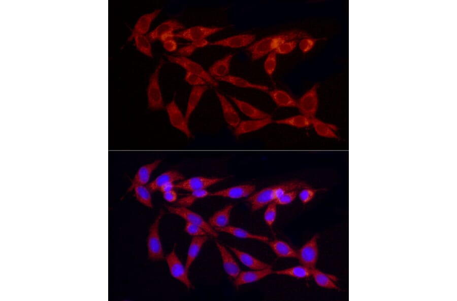 Immunofluorescence - Anti-TGF beta 1 Antibody (A92358) - Antibodies.com