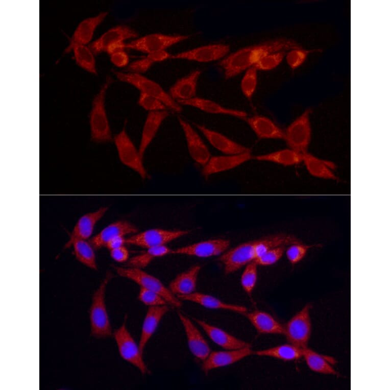 Immunofluorescence - Anti-TGF beta 1 Antibody (A92358) - Antibodies.com