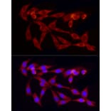 Immunofluorescence - Anti-TGF beta 1 Antibody (A92358) - Antibodies.com