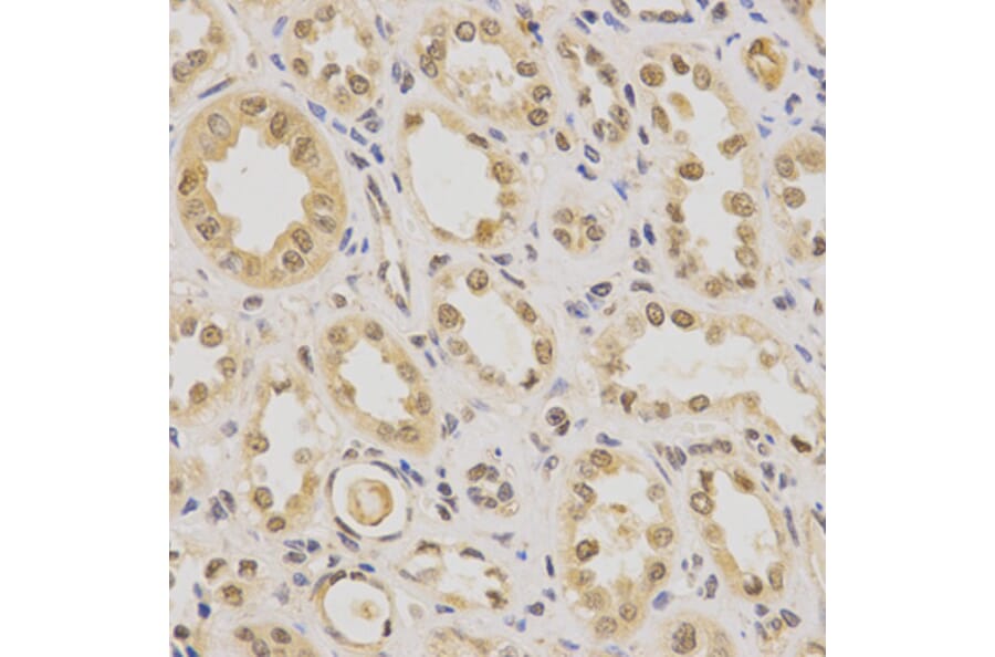 Immunohistochemistry - Anti-PDHA1 Antibody (A13525) - Antibodies.com