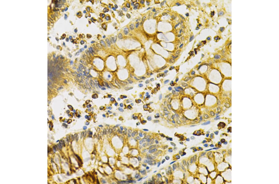 Immunohistochemistry - Anti-PDHA1 Antibody (A13525) - Antibodies.com