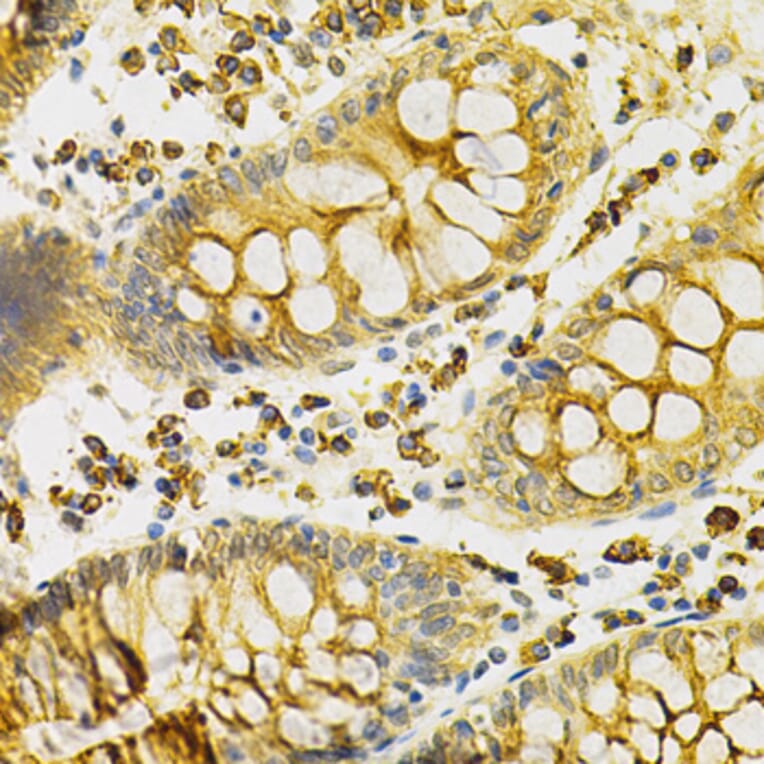 Immunohistochemistry - Anti-PDHA1 Antibody (A13525) - Antibodies.com