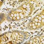 Immunohistochemistry - Anti-PDHA1 Antibody (A13525) - Antibodies.com