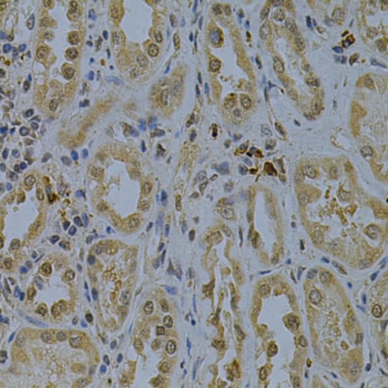 Immunohistochemistry - Anti-PDHA1 Antibody (A13525) - Antibodies.com