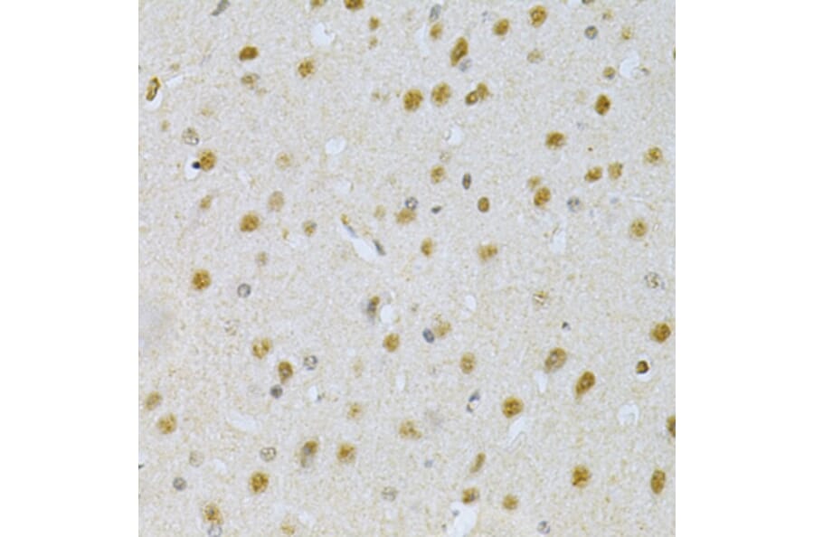 Immunohistochemistry - Anti-PDHA1 Antibody (A13525) - Antibodies.com