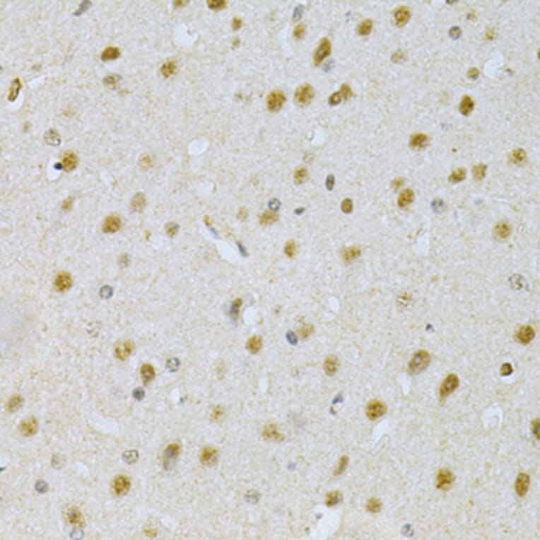 Immunohistochemistry - Anti-PDHA1 Antibody (A13525) - Antibodies.com
