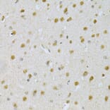 Immunohistochemistry - Anti-PDHA1 Antibody (A13525) - Antibodies.com