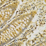 Immunohistochemistry - Anti-PDHA1 Antibody (A13525) - Antibodies.com